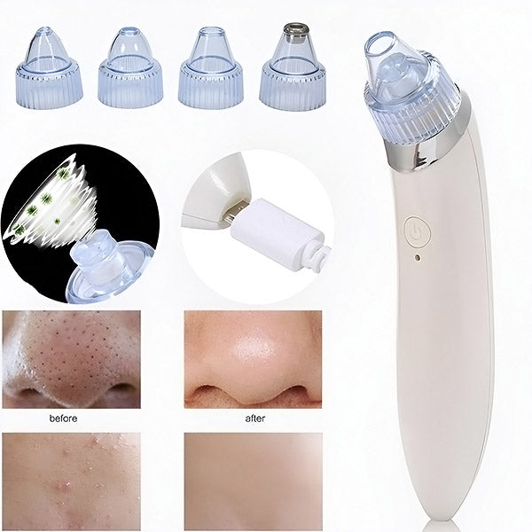 LIMPIADOR FACIAL DE POROS - ELÉCTRICO