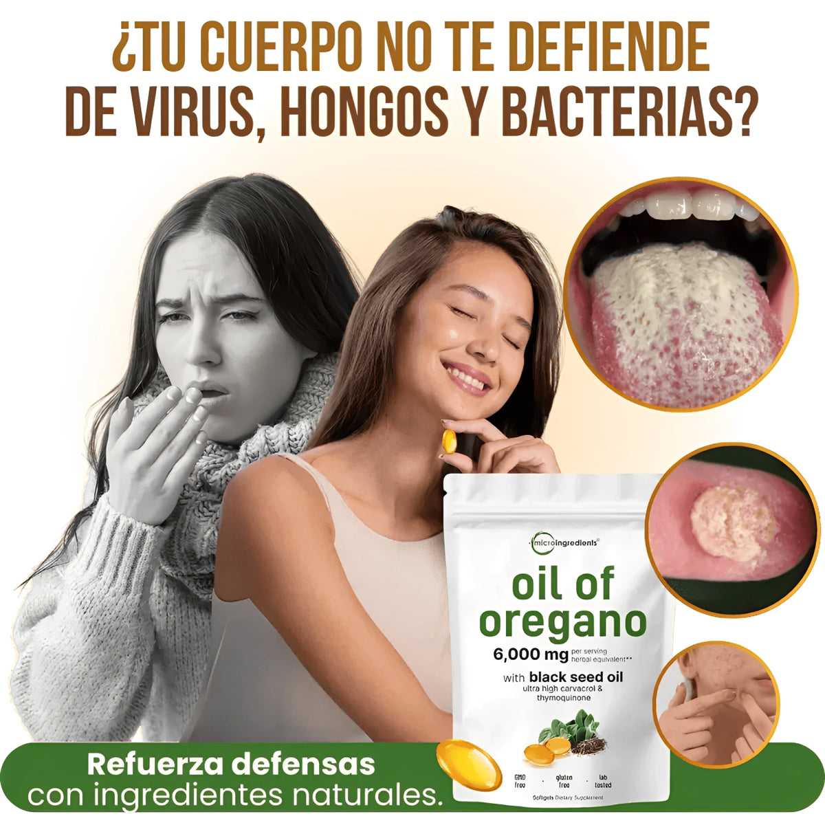 ACEITE DE ORÉGANO | Antiparasitario Natural, Anticandidiasis y Antioxidante